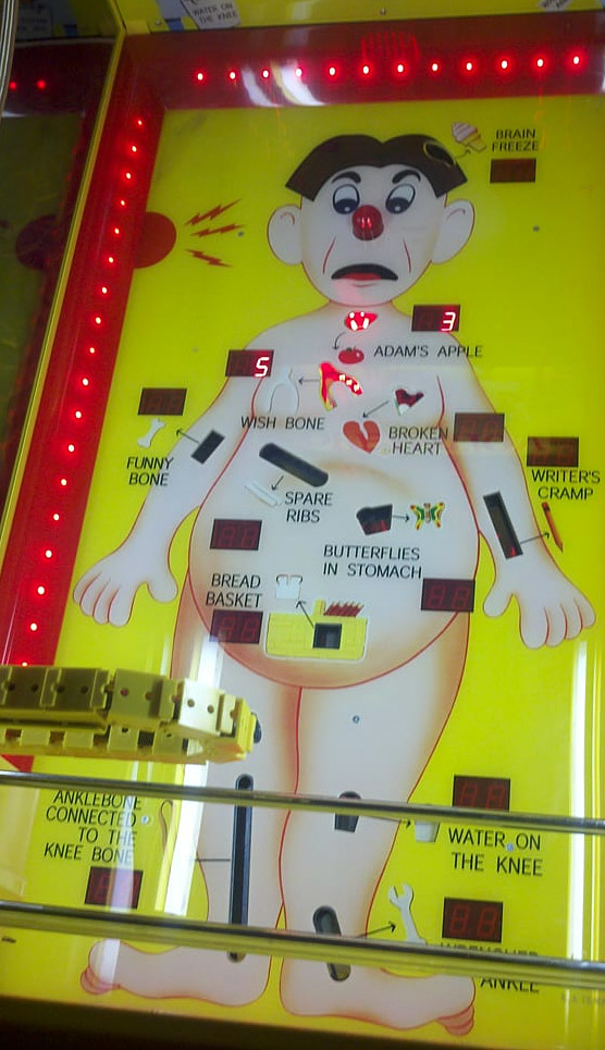The Operation arcade game